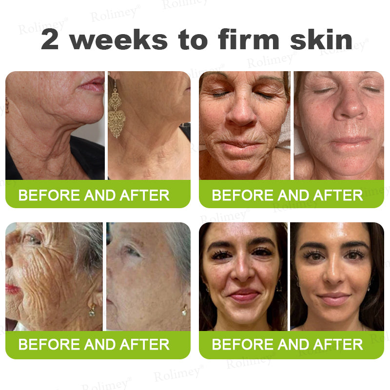 Made and shipped from the USA 💫Rolimey® Botox & Vita-A Retinol Shot Wrinkle-Lift Tightening cream - Last Day Promotion 70% OFF