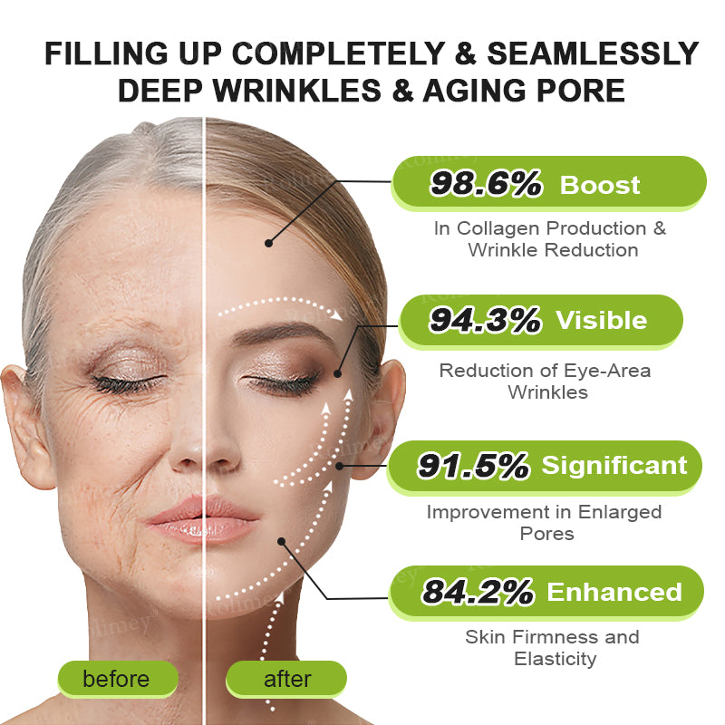 Made and shipped from the USA 💫Rolimey® Botox & Vita-A Retinol Shot Wrinkle-Lift Tightening cream - Last Day Promotion 70% OFF