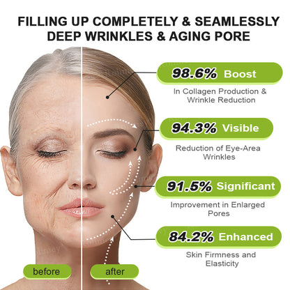 Made and shipped from the USA 💫Rolimey® Botox & Vita-A Retinol Shot Wrinkle-Lift Tightening cream - Last Day Promotion 70% OFF