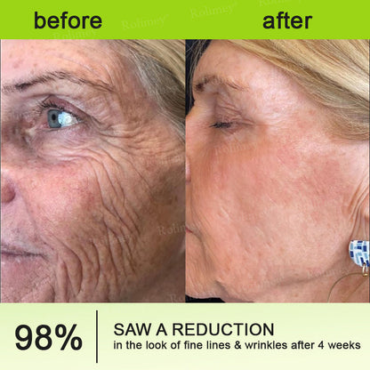 Made and shipped from the USA 💫Rolimey® Botox & Vita-A Retinol Shot Wrinkle-Lift Tightening cream - Last Day Promotion 70% OFF