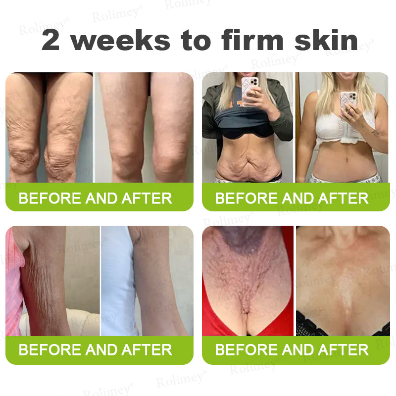 Made and shipped from the USA 💫Rolimey® Botox & Vita-A Retinol Shot Wrinkle-Lift Tightening cream - Last Day Promotion 70% OFF