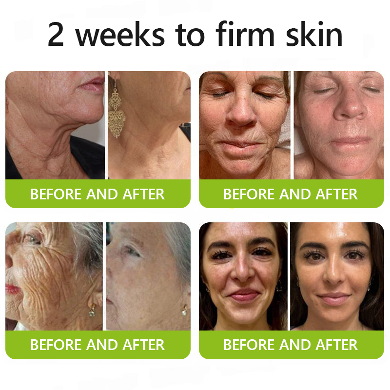 𝑶𝒇𝒇𝒊𝒄𝒊𝒂𝒍 𝑺𝒕𝒐𝒓𝒆👍| Regain youthful skin nown 💫STDEI® BOTOX & VITA A RETINOL SHOT Wrinkle Lift Tightening Cream